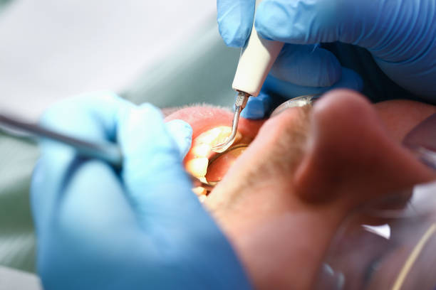 Best Urgent Tooth Repair  in Wchester, IN